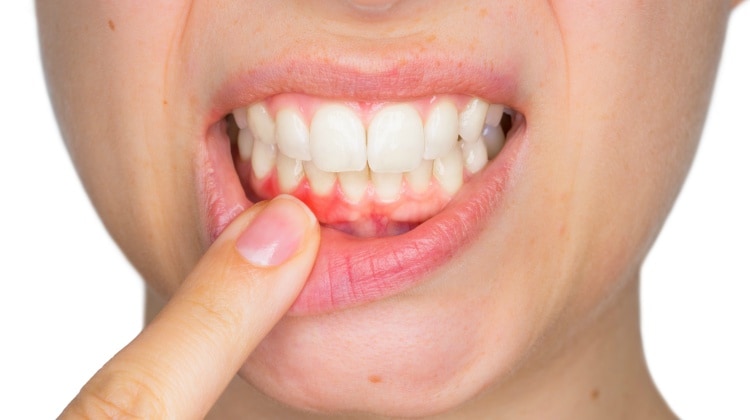 GUM TREATMENT AND SURGERY