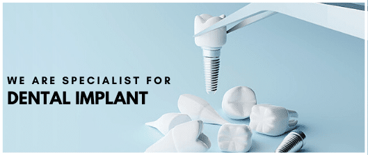 We are Specialist for Dental Implant