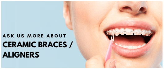 Ask us more about  Ceramic braces / Aligners
