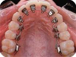 Dr Chopra Dental