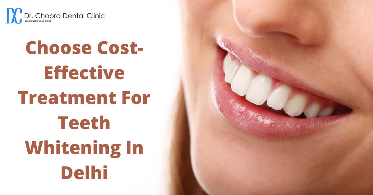 Choose Cost-Effective Treatment For Teeth Whitening In Delhi