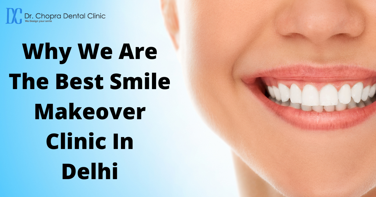 Why We Are The Best Smile Makeover Clinic In Delhi